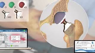 Intellijoint