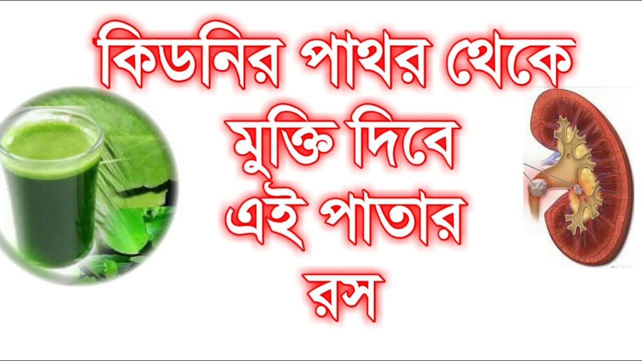 কিডনিতে পাথর হলে করণীয় | ঘরোয়া উপায়ে প্রতিকার | হোমিওপ্যাথি চিকিৎসা | kidney stone in bangla