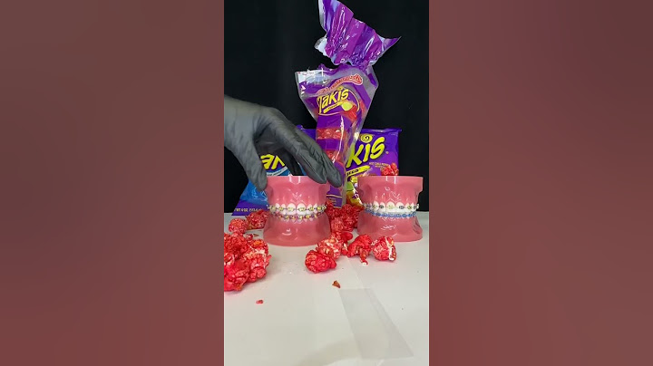 Takis That Are Safe For Braces! [ASMR] 🧑‍🍳🦷 #braces #snacks #asmr