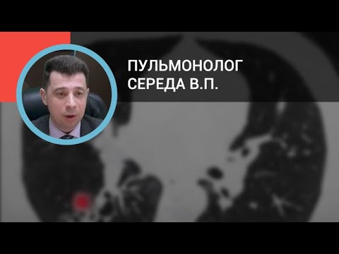 Пульмонолог Середа В.П.: Бронхоэктазии: современные подходы к диагностике и лечению