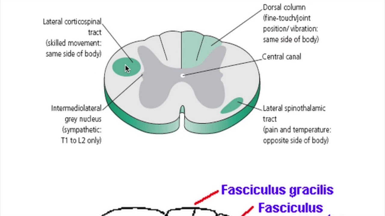 Subacute Combined degeneration YouTube