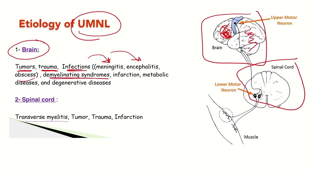 Weakness and hypotonia