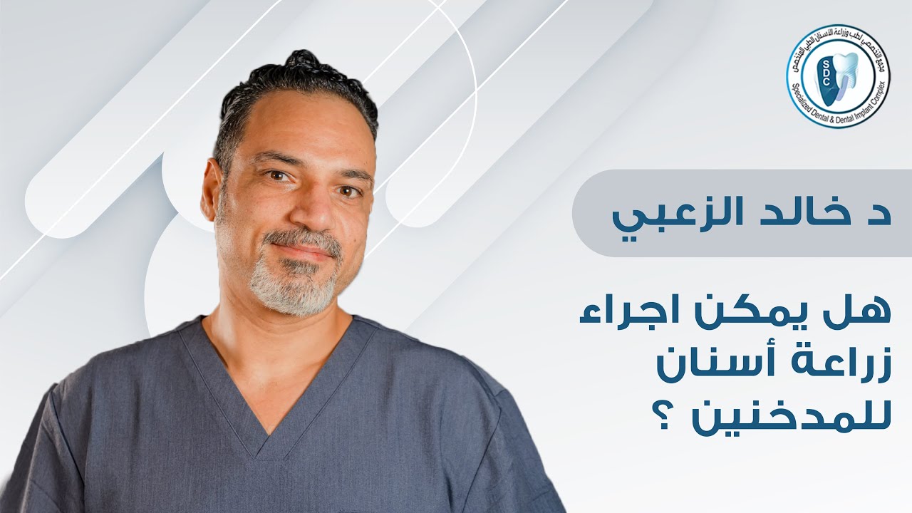 هل يمكن اجراء زراعة اسنان للمدخنين؟ | الدكتور خالد الزعبي