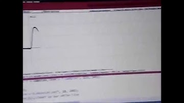 Part 3 DIY OXIMETER Heart Beat Detection and  ARRHYTHMIA using LM386 and Arduino