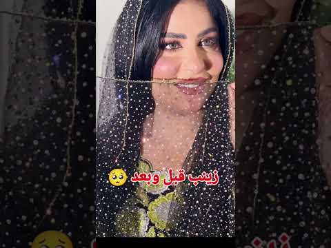 زينب بنت الديوانيه قبل وبعد التجميل