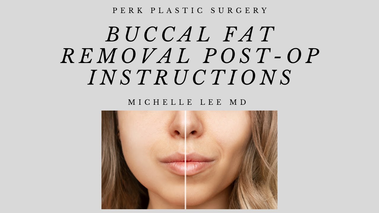 Buccal Fat Removal PostOperative Instructions YouTube
