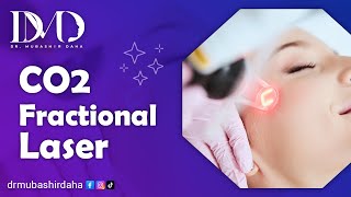 CO2 Fractional Laser for Acne Scars | Dr. Mubashir Daha|Best Skin Specialist&Dermatologist Islamabad