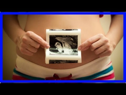 Video: Menstruacija tokom dojenja: uzroci i karakteristike