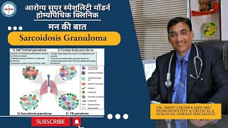 Sarcoidosis Granulomas treatment at Dr. Arpit Chopra Jain Aarogya SuperSpeciality Modern Homoeopathy