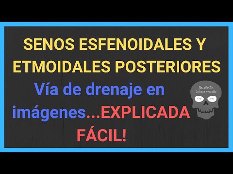 SENO ESFENOIDAL y CELDILLAS ETMOIDALES POSTERIORES: 💦 drenaje (TAC)