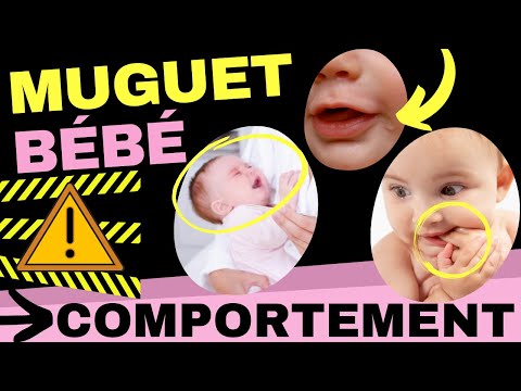 Vidéo: Mon bébé pourrait-il avoir un serre-langue ?