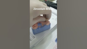 Zirconium Bridge #dental #shorts #youtubeshorts #short #zirconia