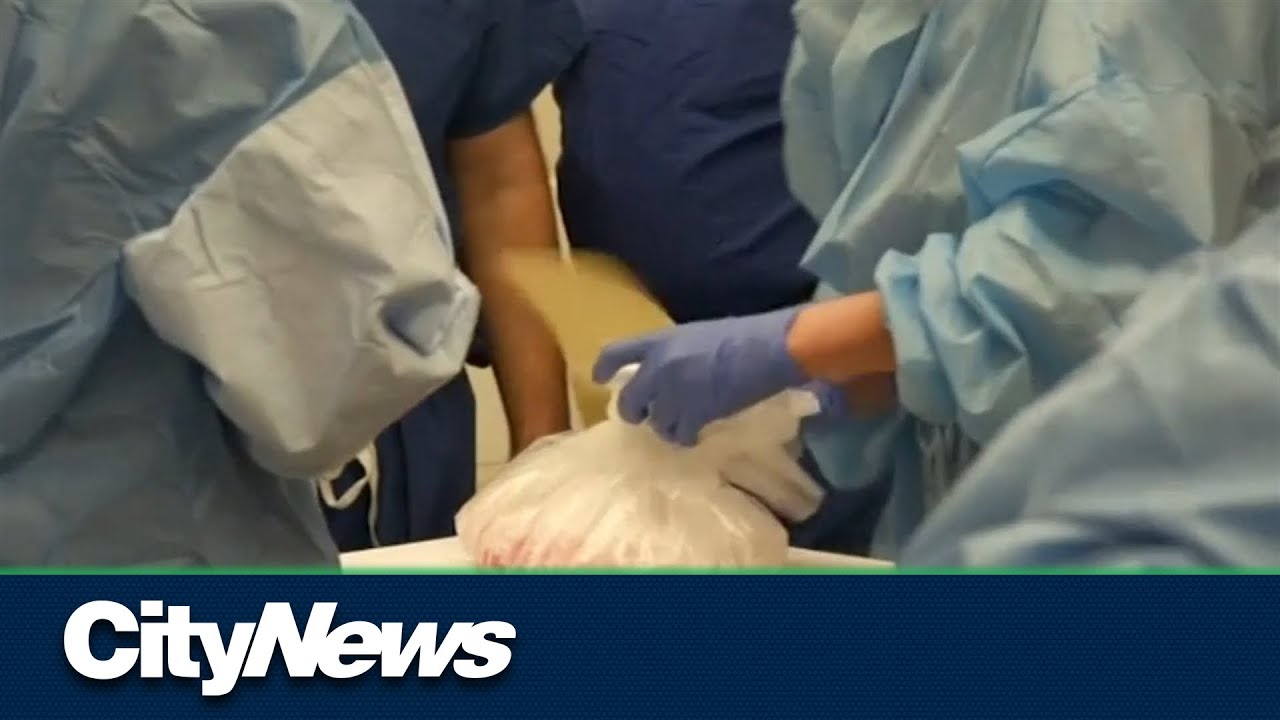 Calls for organ donation legislation in Quebec