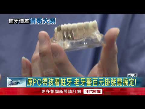 差很大！ 6顆蛀牙「報價11萬 vs. 百元搞定」 牙醫曝治療真相