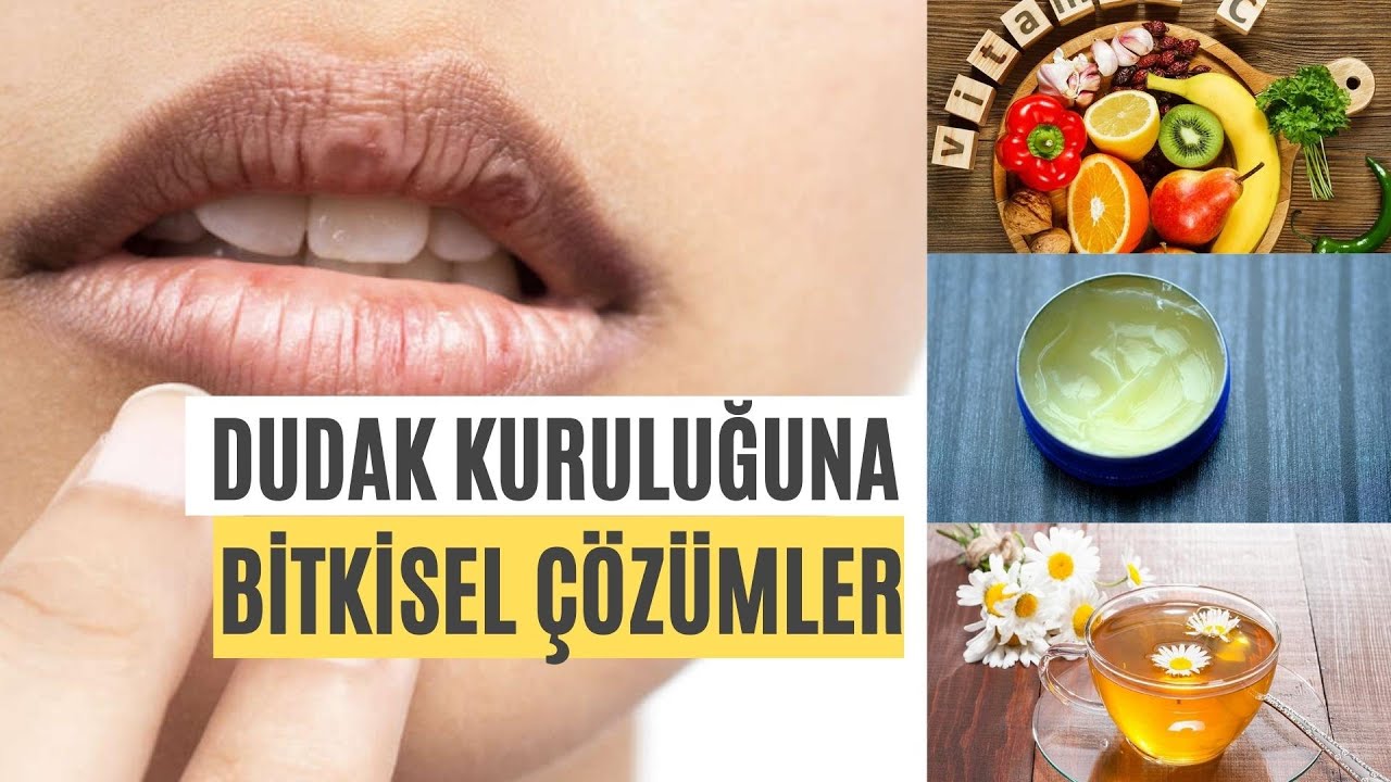 Dudak Kuruması Neden Olur? Nasıl Geçer? - YouTube