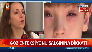 Göz Enfeksiyonu Salgınına Dikkat - 03072018 Kisa Haber