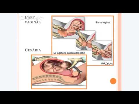 Vídeo: L'osteopatia cranial pot ajudar al reflux en els nadons?