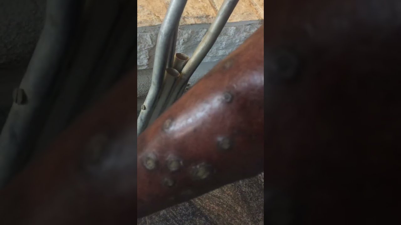 Necrobiosis Lipoidica