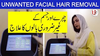 IPL Laser Teatment for Unwanted Hair by Dr. Umme Raheel