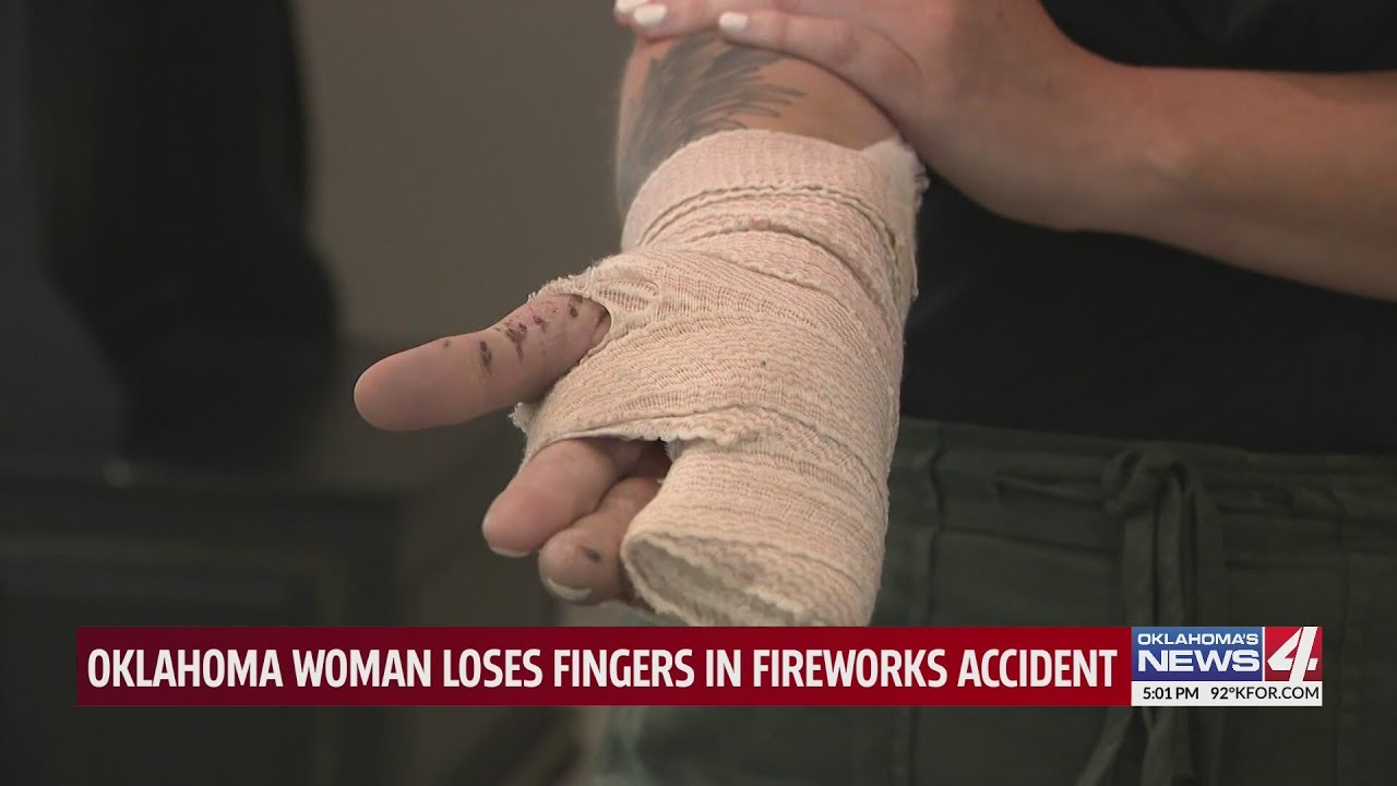 Oklahoma woman loses fingers in fireworks accident