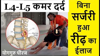 कमर की दबी नस का बिना सर्जरी ईलाज। Slip Bulge Disc L4-L5 Nerve Back Pain Treatment Yog Guru Dheeraj