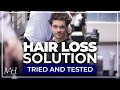 A Treatment To Prevent Hair Loss |  I Tried Scalp Dermabrasion | Thicker Hair