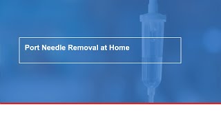 Port Needle Removal at Home