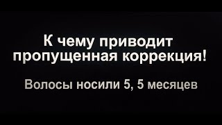 Опасность в наращивании:к чему приводит пропущенная коррекция!