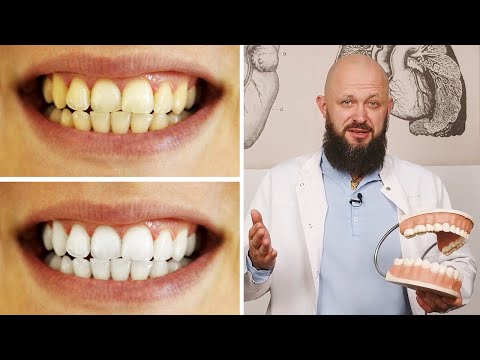 Видео: 3 способа быстро отбелить зубы