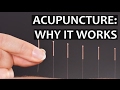 Acupuncture: science or myth