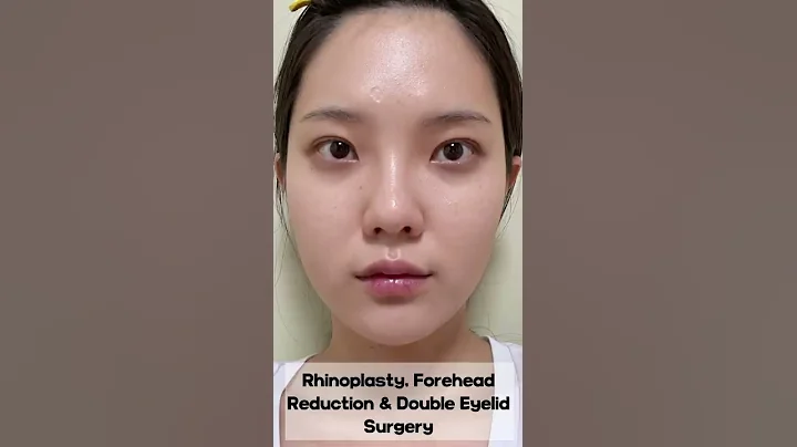 [Plastic Surgery in Korea] Rhinoplasty, Forehead Reduction & Double Eyelid Surgery at DA! #shorts - DayDayNews