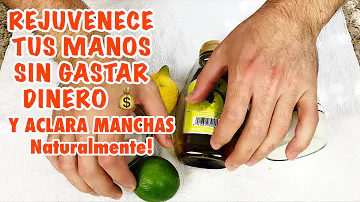 ¿Qué ingrediente elimina las manchas de la edad?