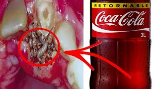 🤧 10 Enfermedades Que Le Pasa A Tu Cuerpo Al Tomar Coca Cola