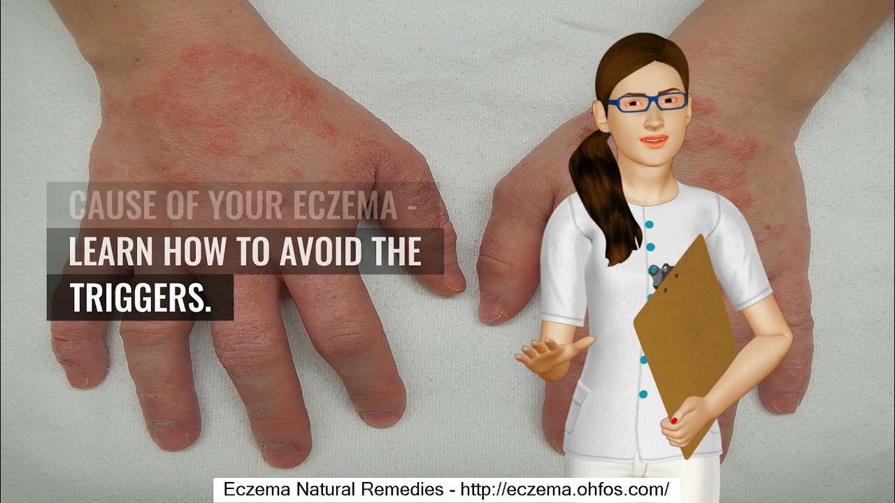 Can You Get Eczema Under Your Nails YouTube