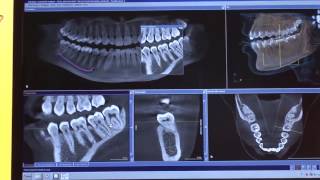 Sirona presenta ORTHOPHOS XG 3D - YouTube