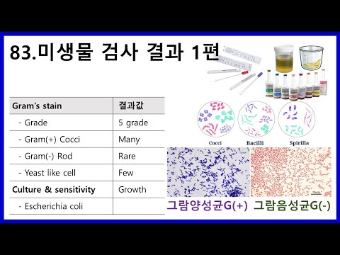 83. 미생물 검사 결과 1편 - gram stain? grade?? S, R, I???