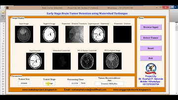 Matlab code for Early Brain Tumor Detection and Classification using Watershed Technique