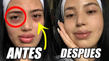 ¿Cómo puedo aclarar mis ojeras en una semana?