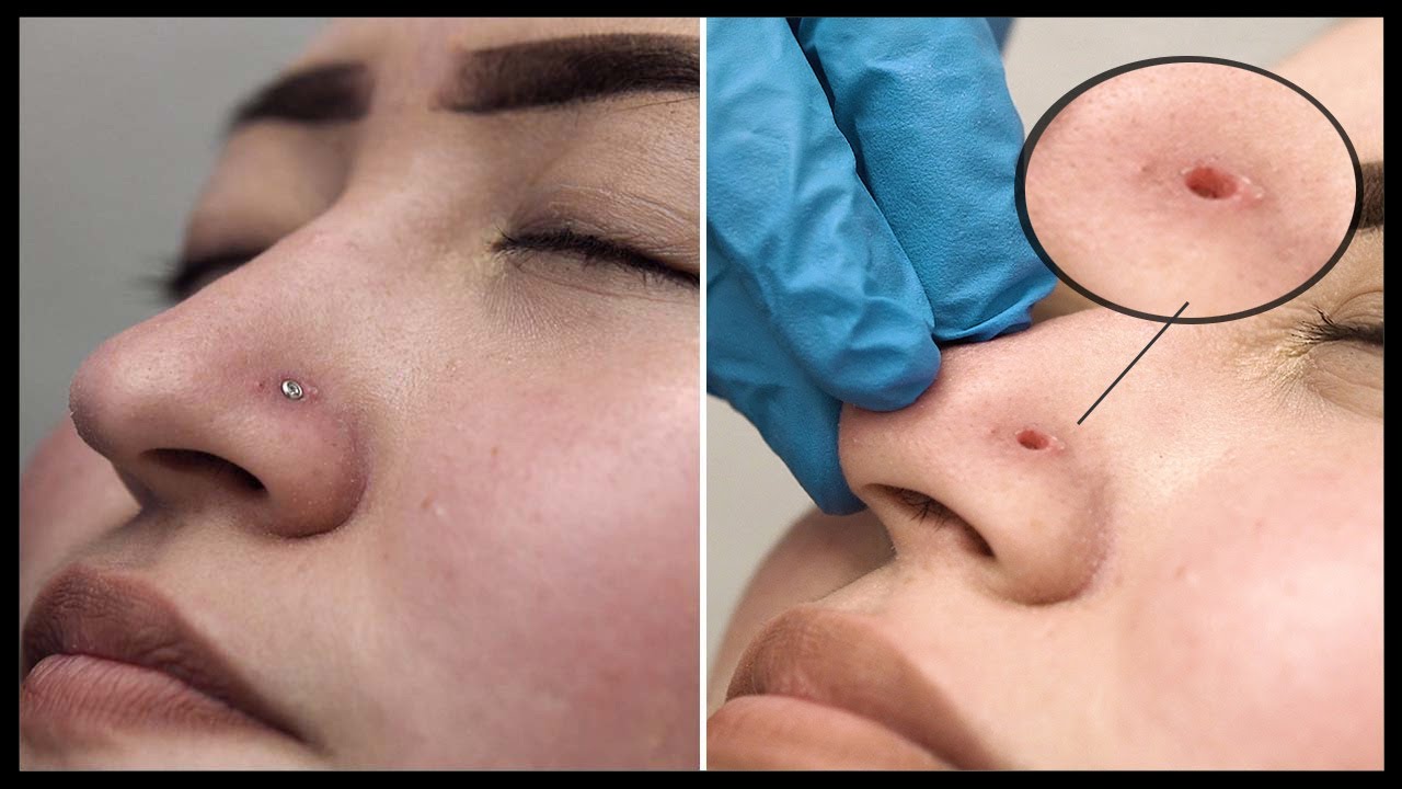 How To Put In A Hoop Nose Ring – Dr. Piercing Aftercare