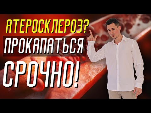 Инфузионная терапия при облитерирующем атеросклерозе | Тайна