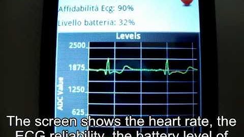 Android ECG 3