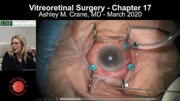 Surgical Retina - Ashley Crane, MD - BSCS Chapter 17