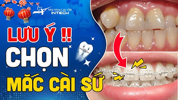 Mắc Cài Sứ, 3 Điều Nhất Định Bạn Phải Biết Trước Khi Lựa Chọn | Nha Khoa Lạc Việt Intech