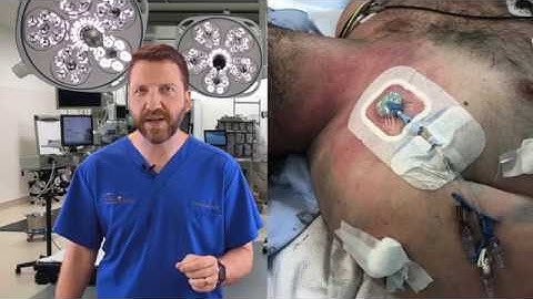 Trauma in a Flash: Central Line Insertion