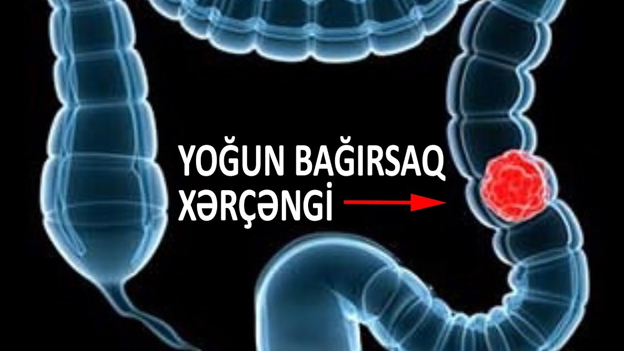 bağırsaq