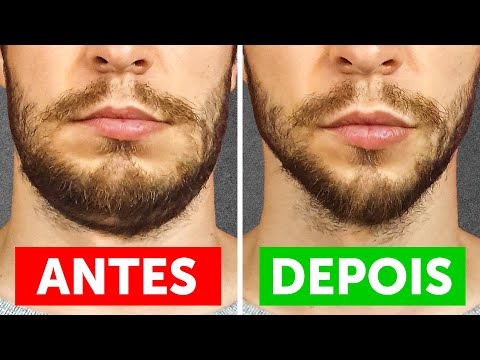 Vídeo: Como Remover O Queixo Nos Homens