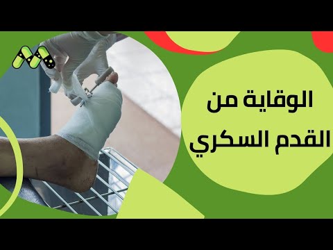 القدم السكري كيف تتجنب البتر وتحافظ على صحة قدميك مع د زكي مدبولي