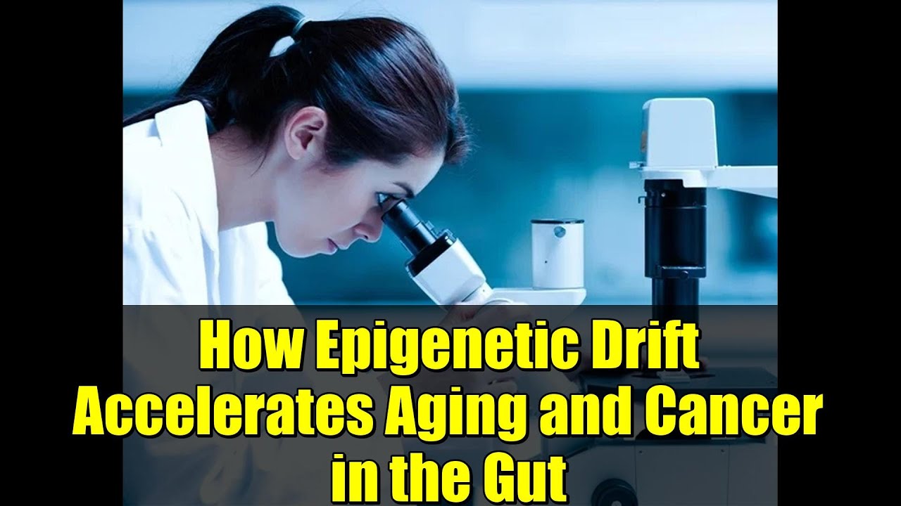 How Epigenetic Drift Accelerates Aging and Cancer in the Gut