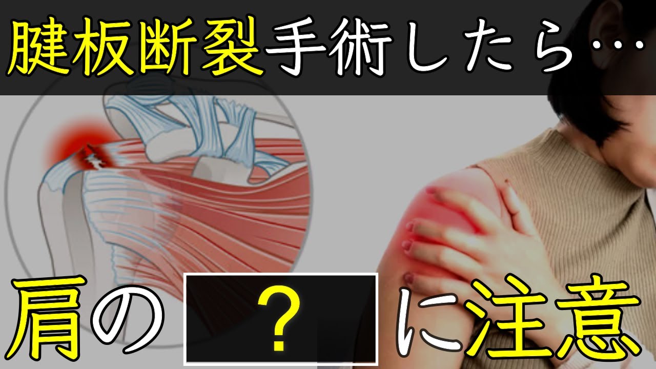 【完全解説】腱板断裂手術後のリハビリと注意点「夜間痛/可動域制限/日常生活の工夫」