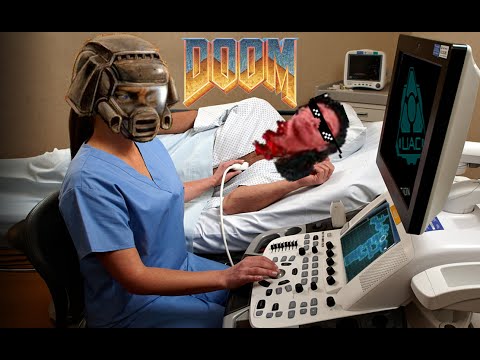 Doom running on GE Vivid S5 Ultrasound